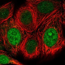 WBSCR22 Antibody, Novus Biologicals:Antibodies:Primary Antibodies